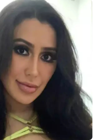 Woman spent Rs 48 lakh on surgery to look like Kim Kardashian