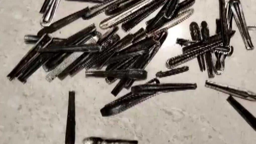 Doctors removes 62 spoons from young man stomach