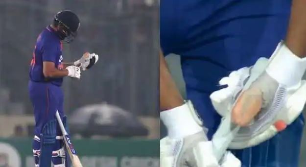 Rohit sharma injured thumb viral pic after he batting for india