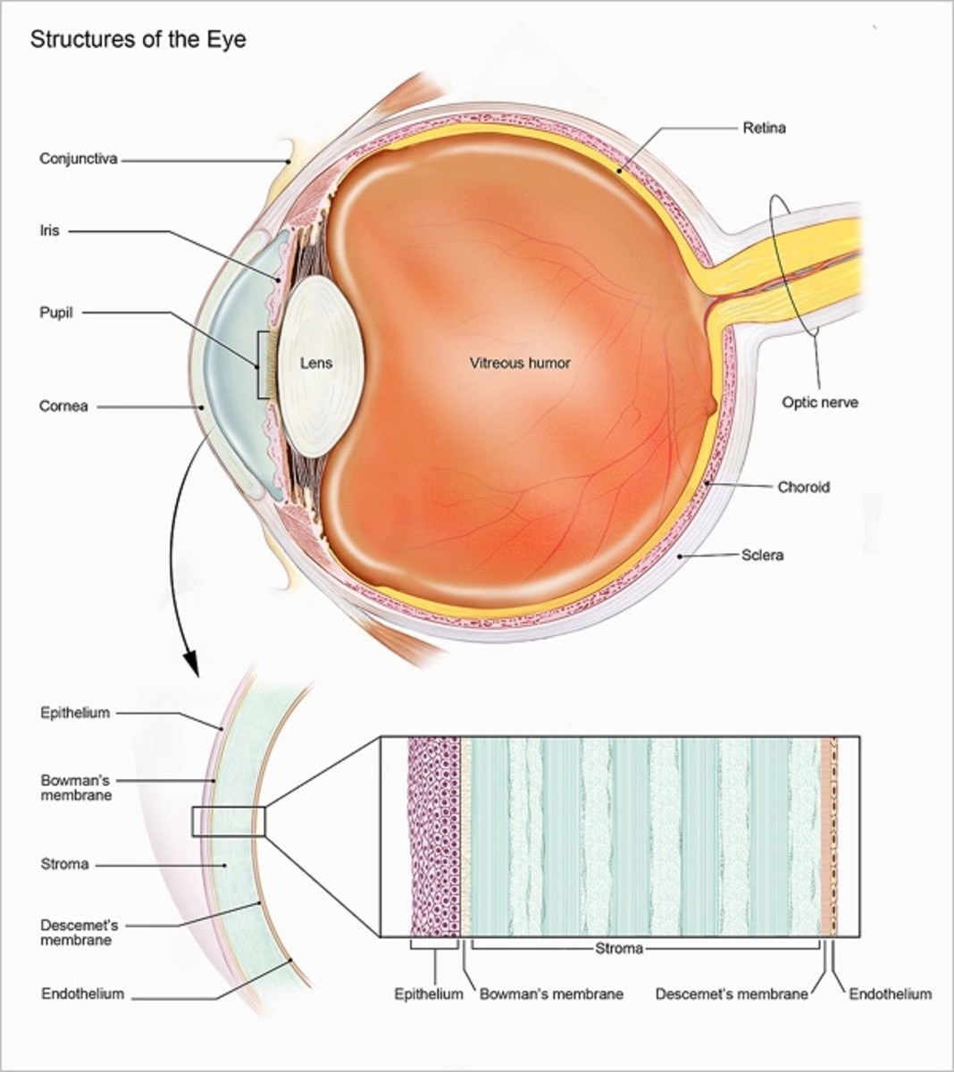 parasites cause a man eye blind after he sleeps with contact lense